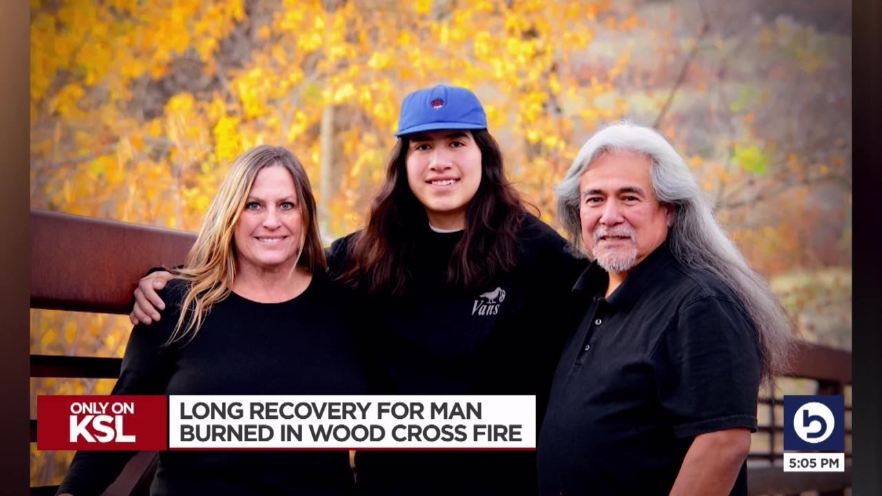 Woods Cross man severely burned in explosion grateful to heroes who rushed to help