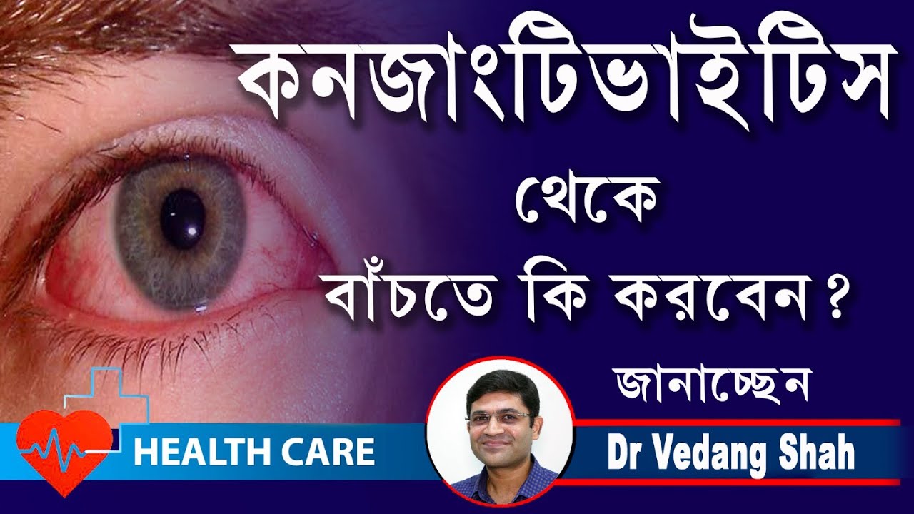 কনজাংটিভাইটিস থেকে বাঁচতে কি করবেন জানাচ্ছেন Opthalmologist || Dr. Vedang Shah