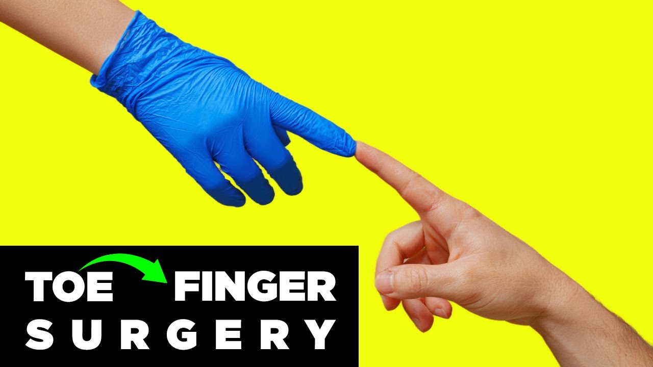 Missing Finger? How Toe Transplant Surgery Actually Works