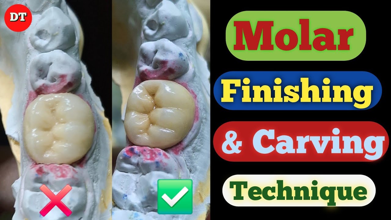 Molar anatomy & Carving| Ceramic finishing video| dental technician| posterior Anatomy| dental video