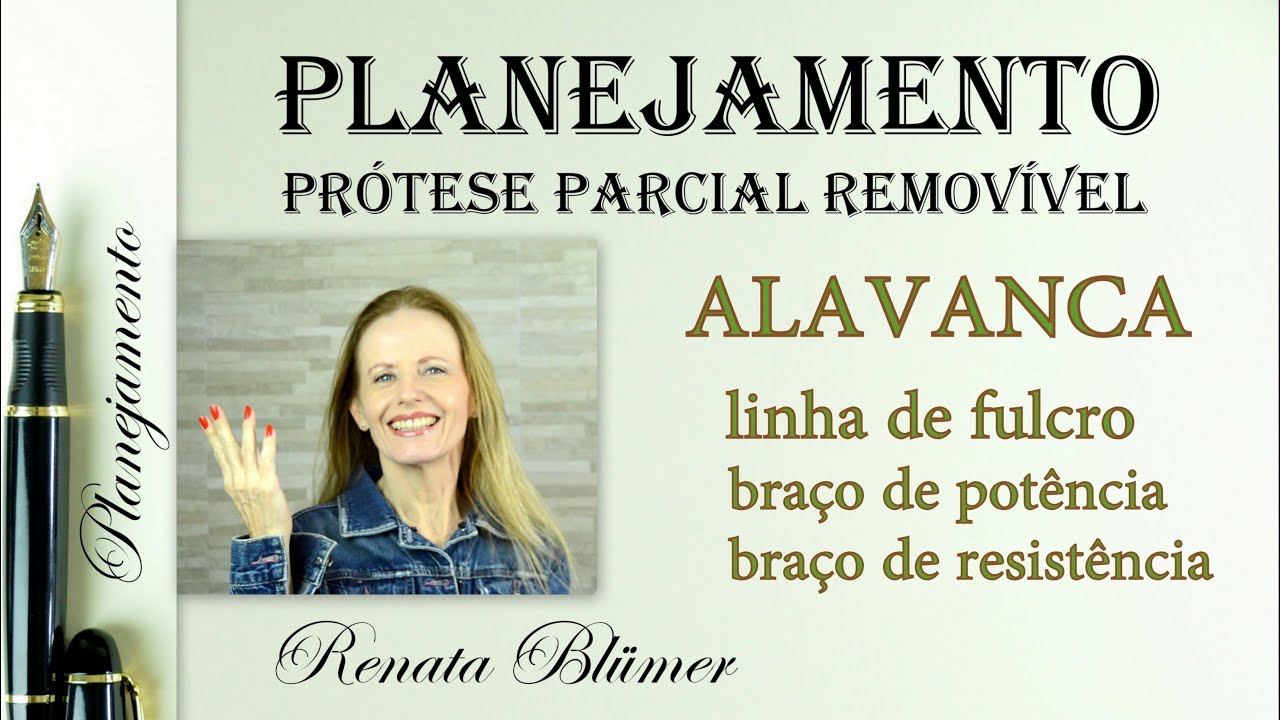 PPR - PLANEJAMENTO  - ALAVANCA - EQUILIBRIO