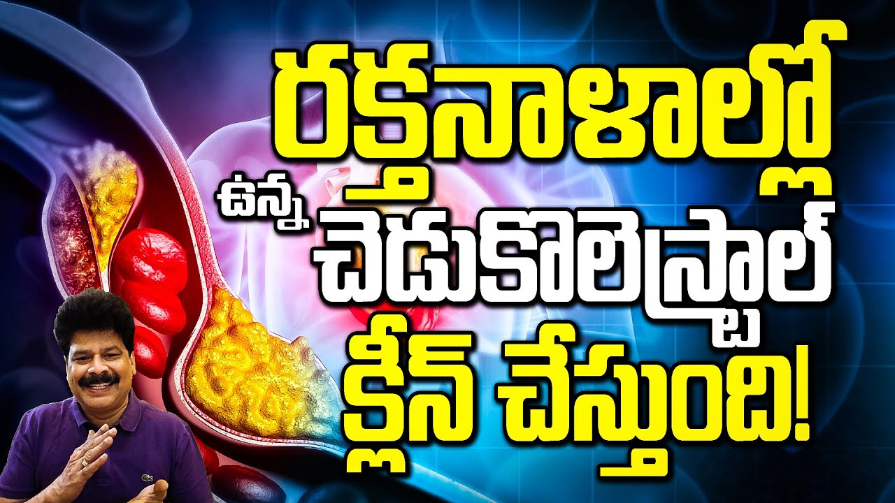 రక్తనాళాల్లో ఉన్న చెడు కొలెస్ట్రాల్ క్లీన్ చేస్తుంది | How to Burn Bad Cholesterol | Blood Thinner