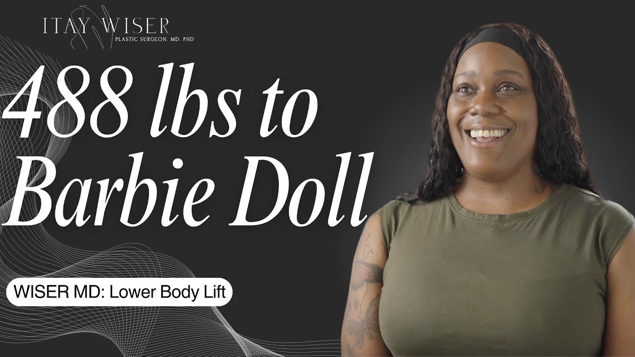 From 488 Pounds to Barbie Doll: A Stunning Transformation