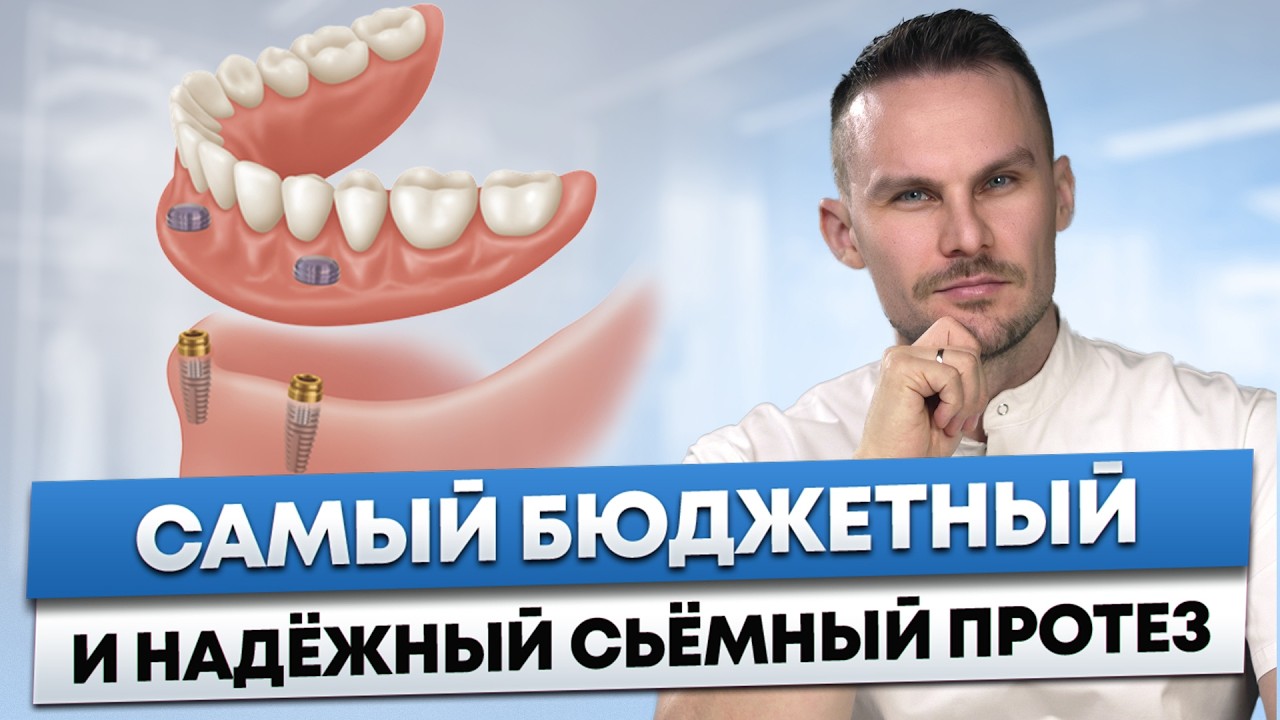 Лучшая альтернатива имплантам в 2026 – Протез, который НЕ ВЫПАДАЕТ и сохраняет кость