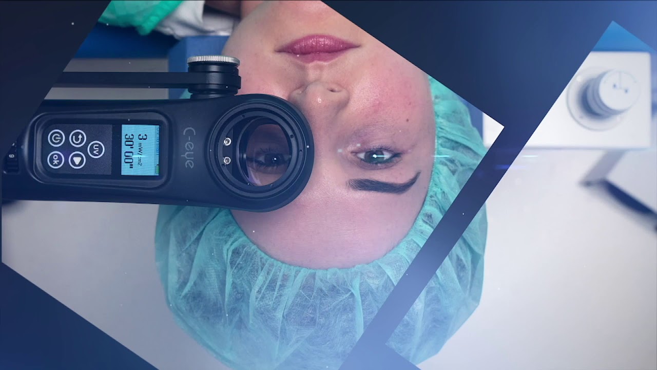 C-eye - Technical Features