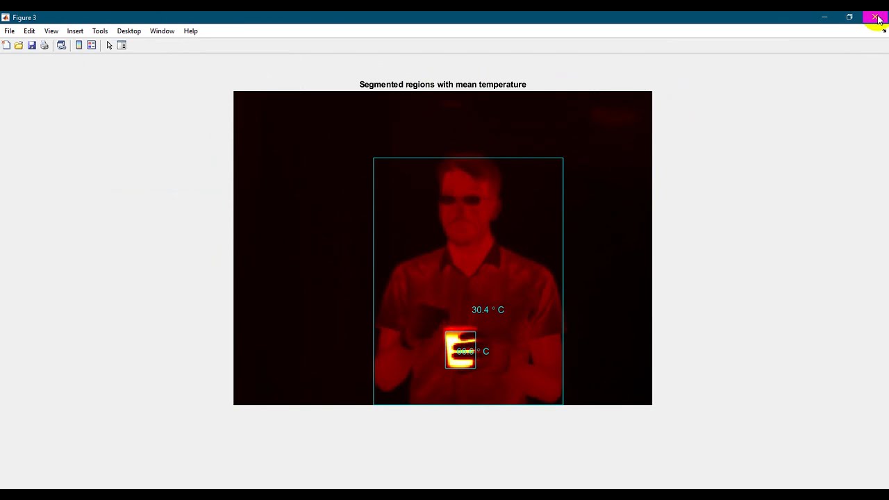 Segment Thermographic Image after Edge Preserving Filtering