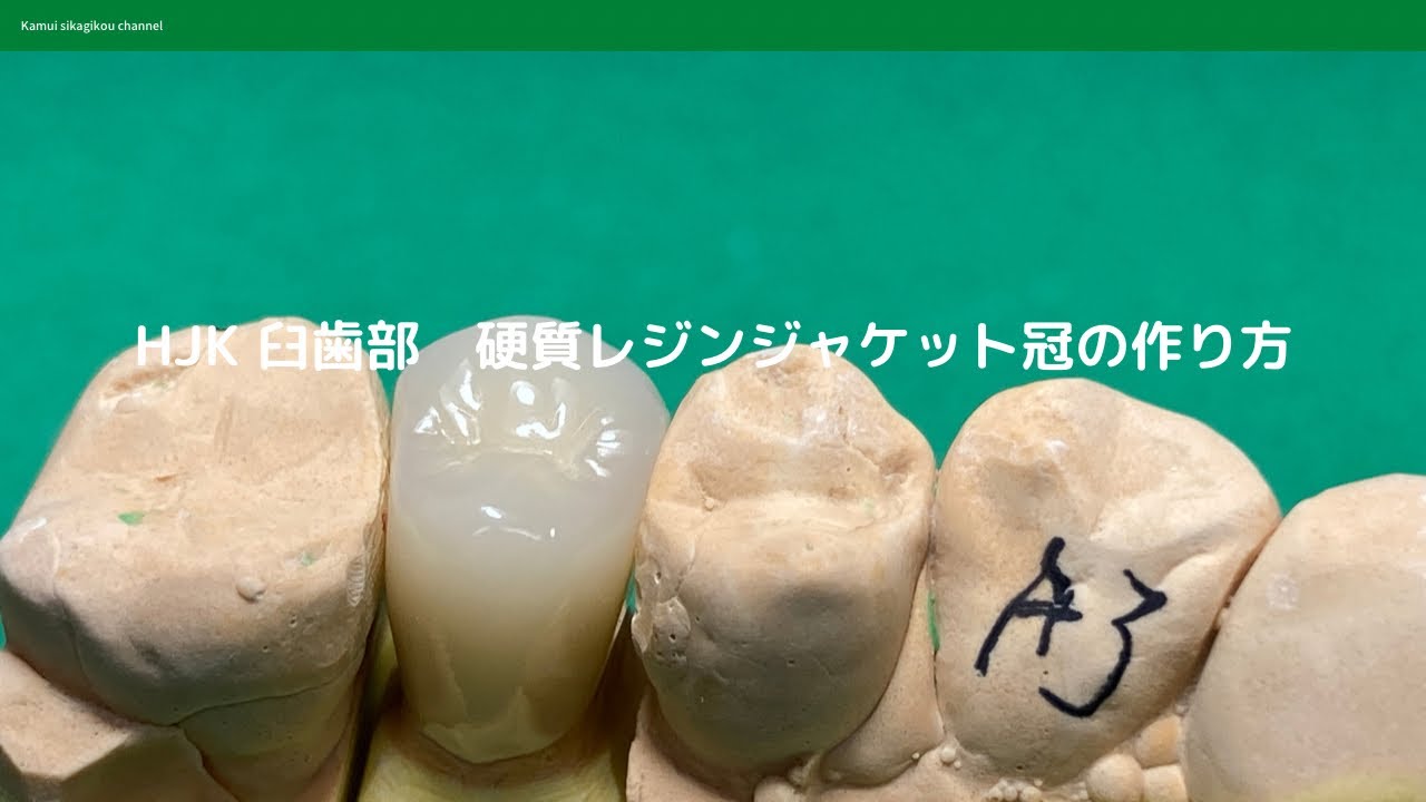 【歯科技工士】HJK小臼歯硬質レジンジャケットの作り方