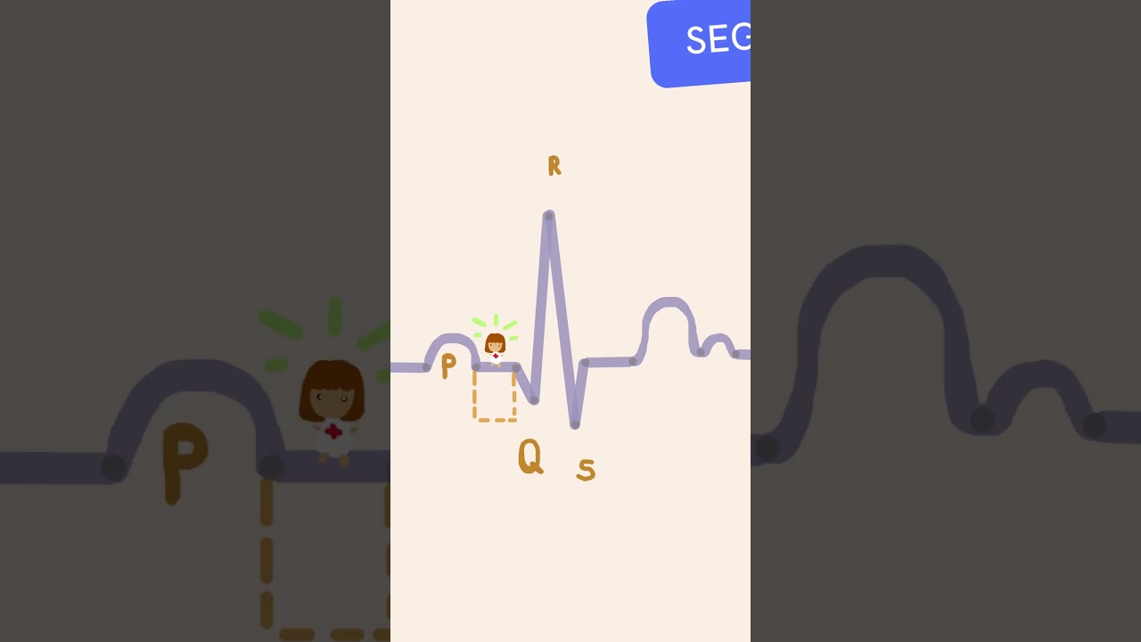 Intervalos y segmentos ECG