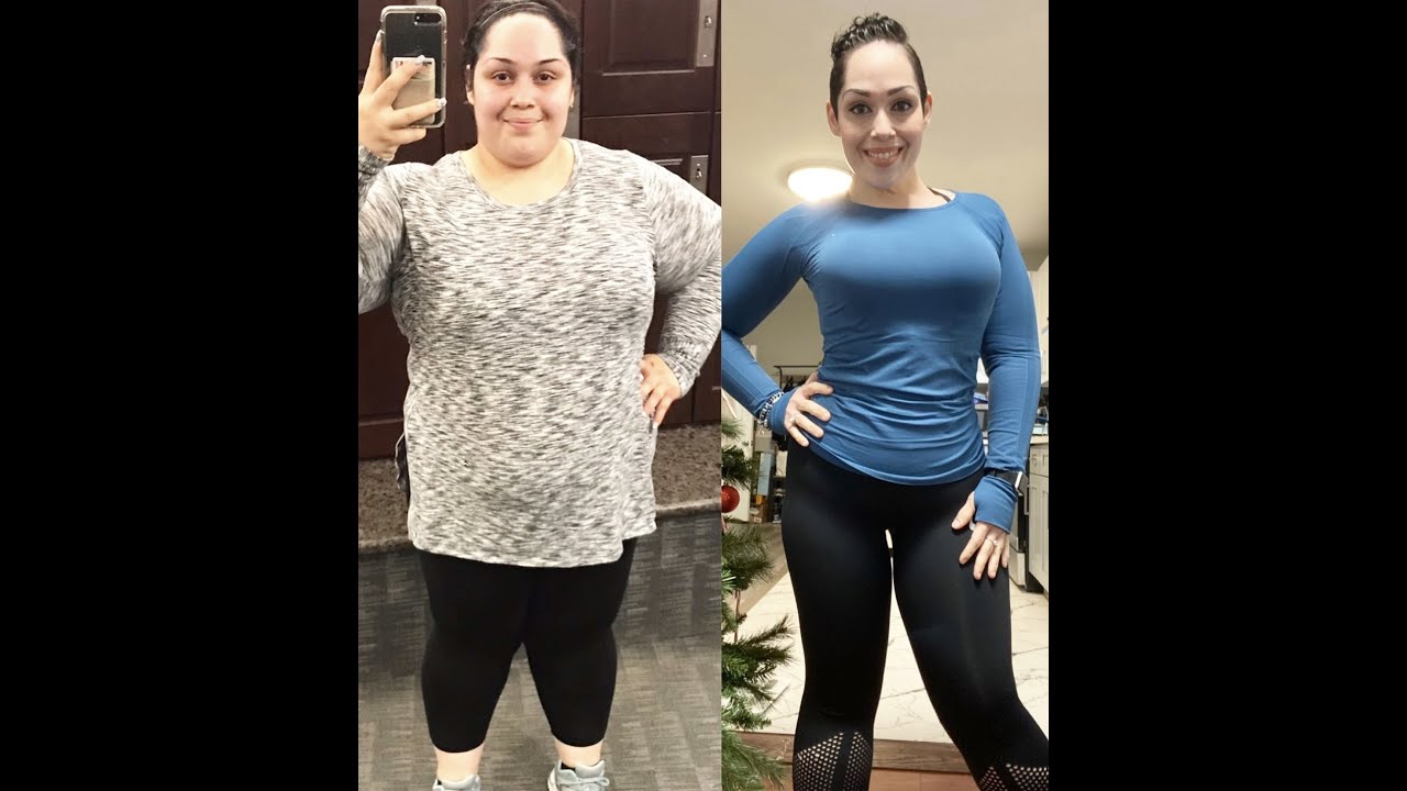 311.8 lbs vs 165 lbs after having VSG surgery my transformation video ! 145 lbs lost