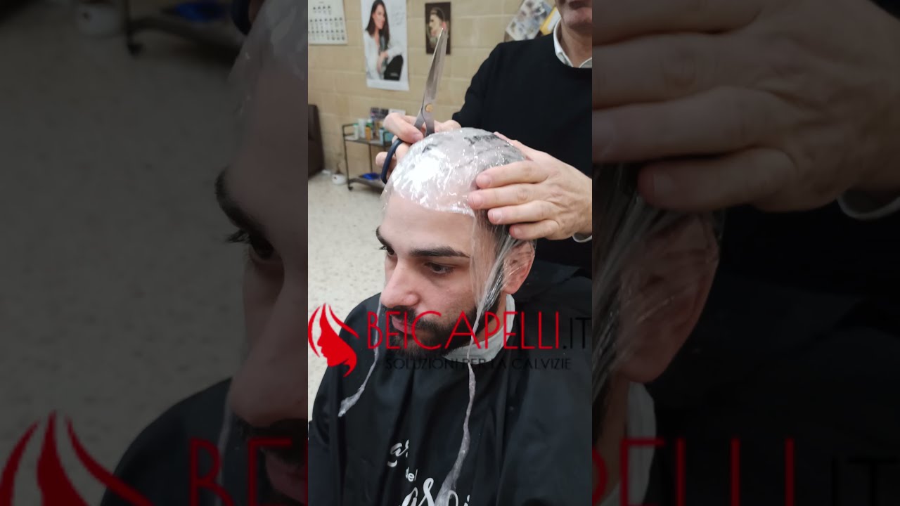 Fase 2: Realizzare il calco per protesi capelli