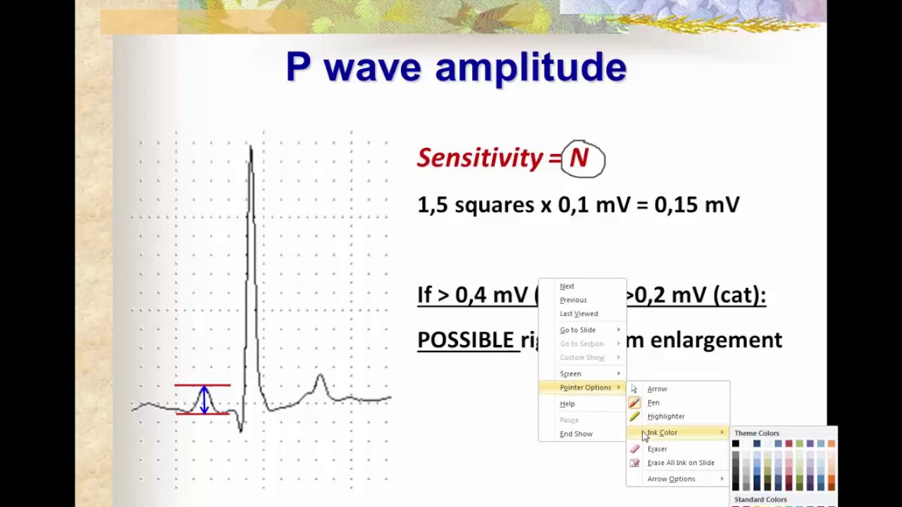 How to evaluate the morphology of P waves in ECG traces of dogs and cats.