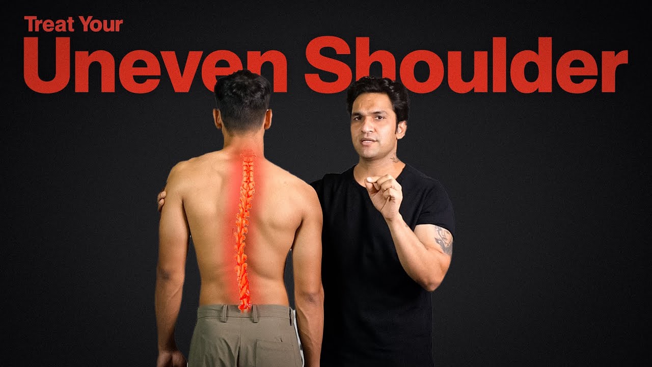 How to Fix Uneven Shoulders | Causes, Pain & Exercises