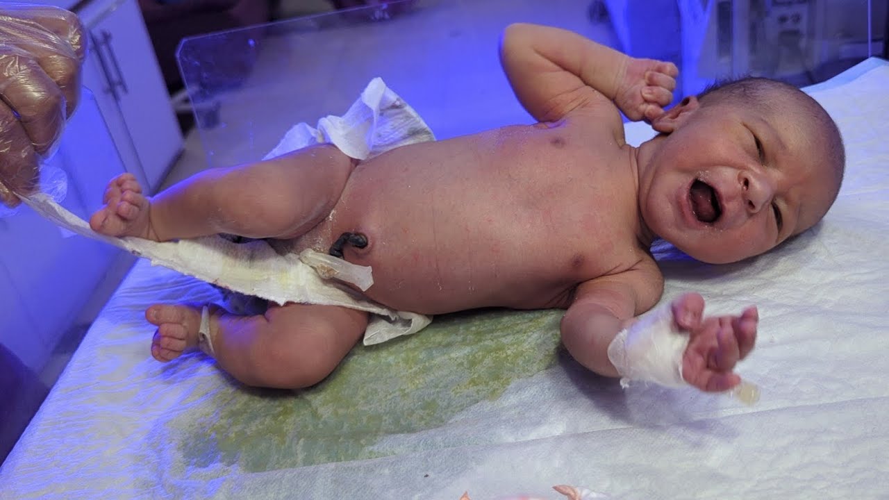 So Cute! Newborn Baby Passing Urine on Warmer 😃💧