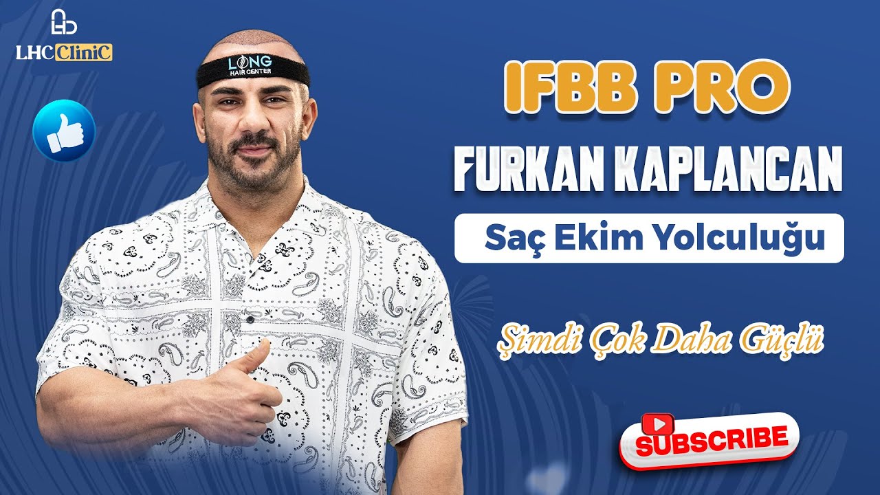 IFBB PRO Furkan Kaplancan’ın Saç Ekimi Serüveni: Güç ve Yenilenme Hikayesi!