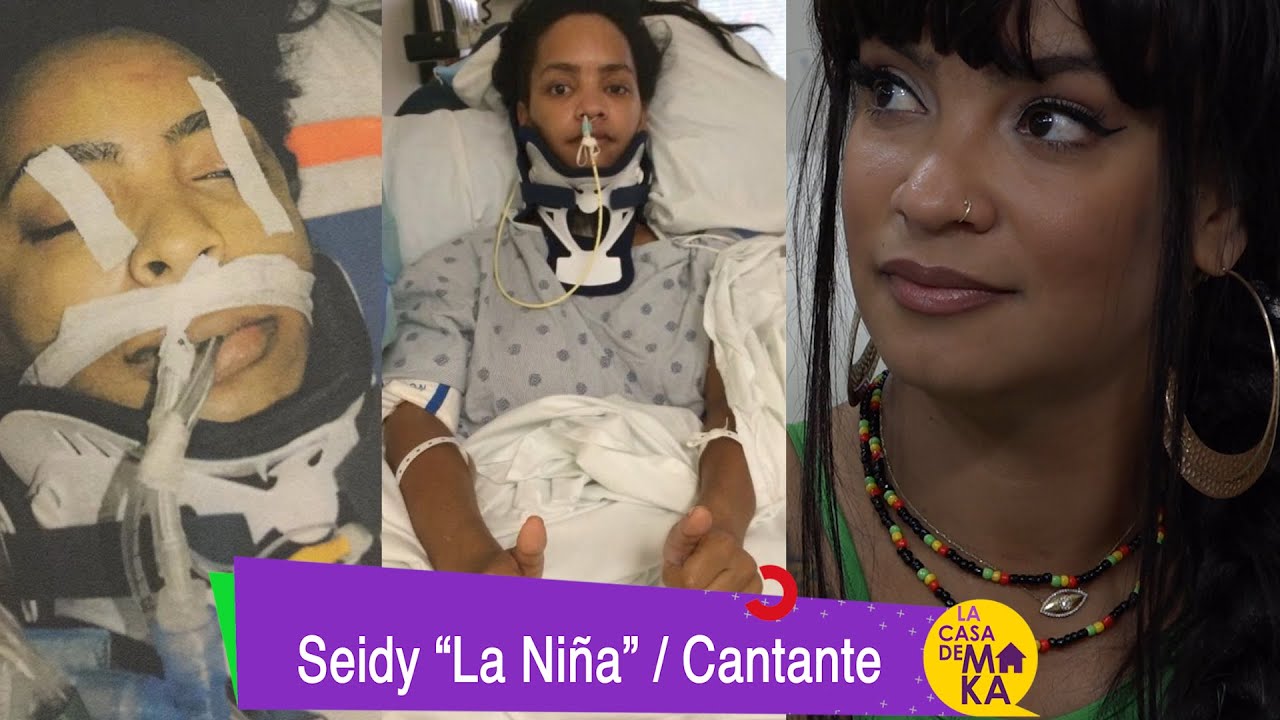 Terrible Accidente sufre joven cantante cubana que casi la deja sin vida. 