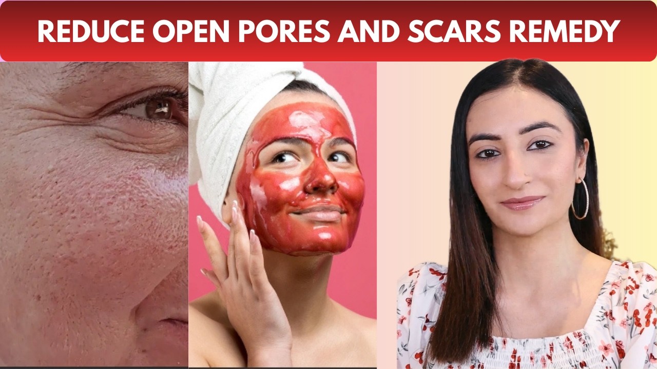 I Tried Home Remedies for Open Pores and Got AMAZING Results