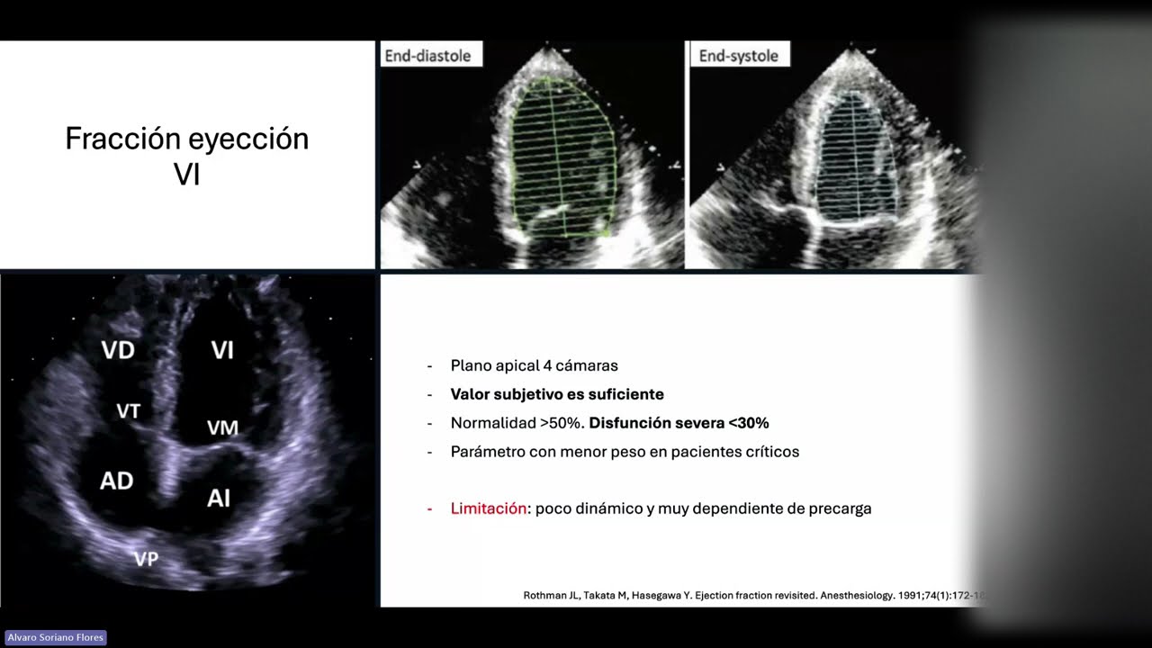 Ecocardiografía en el paciente en Shock - Dr. Soriano