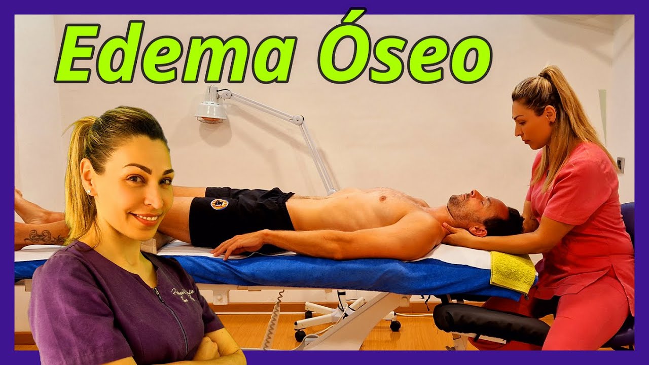 🟣EDEMA ÓSEO, Qué es?Tratamiento fisioterapia completo/CASO REAL🙌🏼#fisioterapia#osteopatia