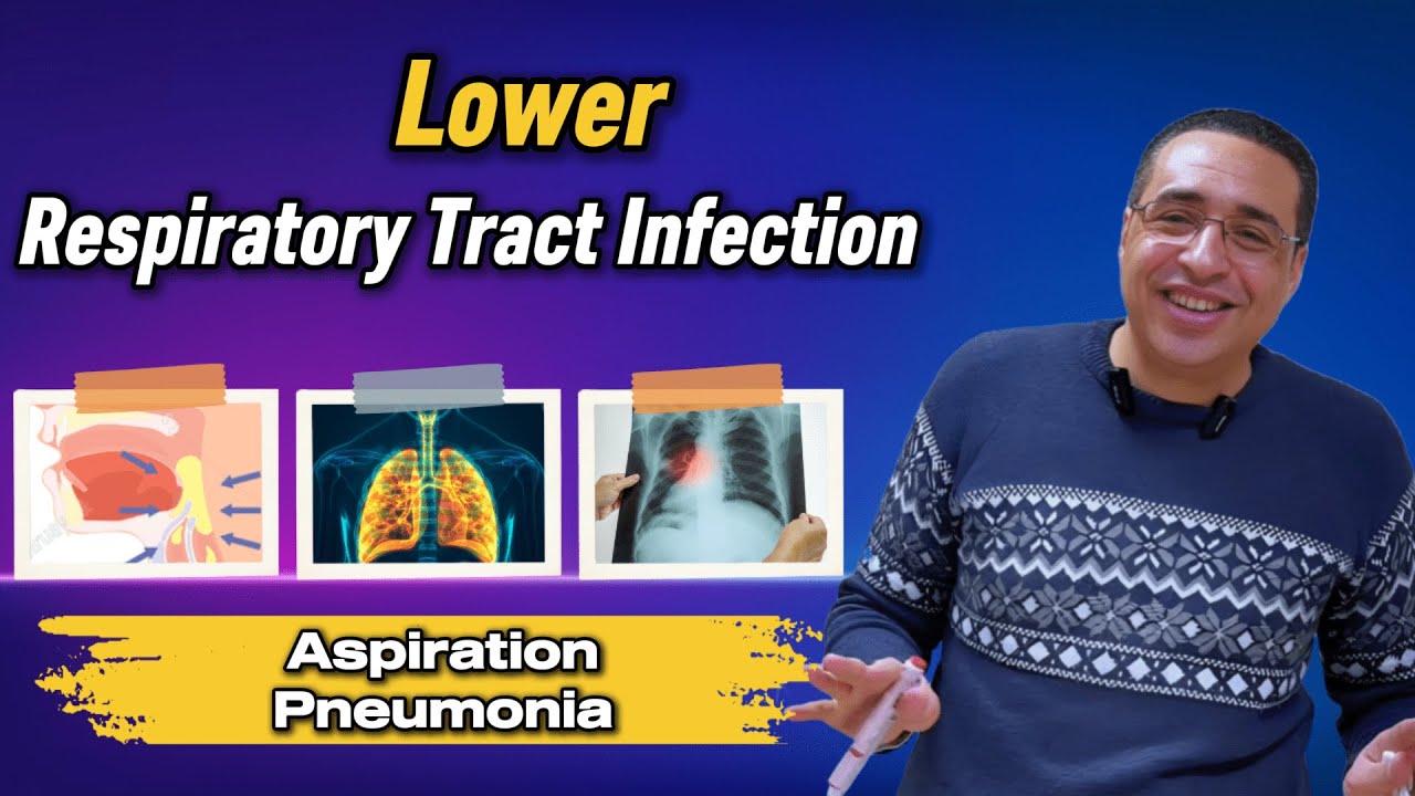 Chest - 05 - ll Lower RTI ll { Aspiration Pneumonia }