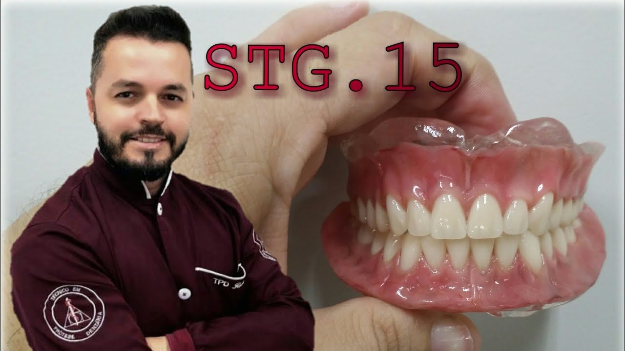 Stg/ acrilizando uma stg 15