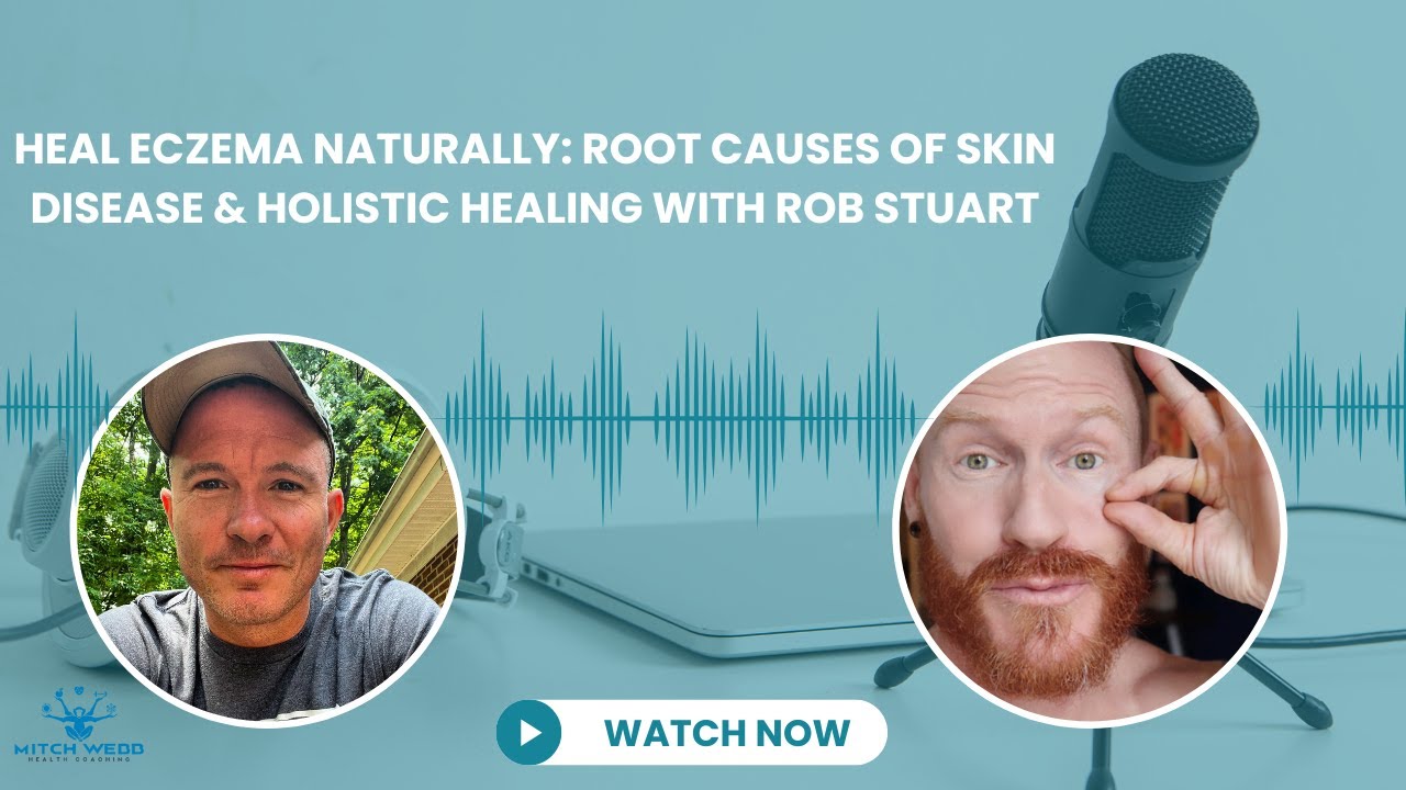 Heal Eczema Naturally: Root Causes of Skin Disease & Holistic Healing with Rob Stuart