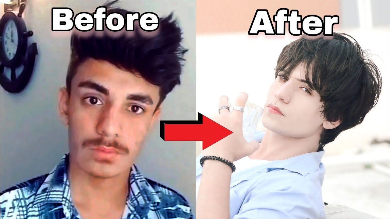 How i Glow up?😮 Part: 2 [ Without Any Surgery]
