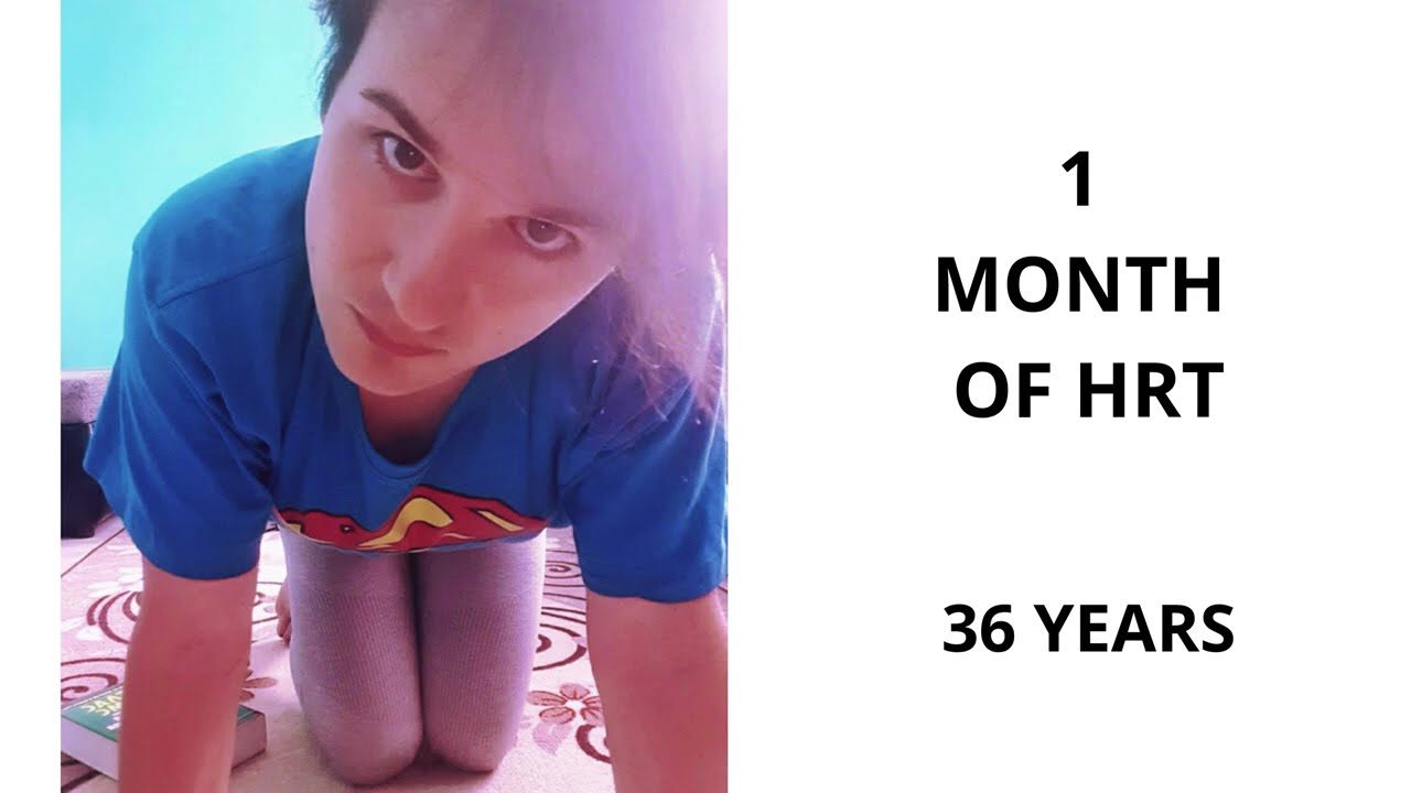 MTF Transition Timeline - 16 months on HRT