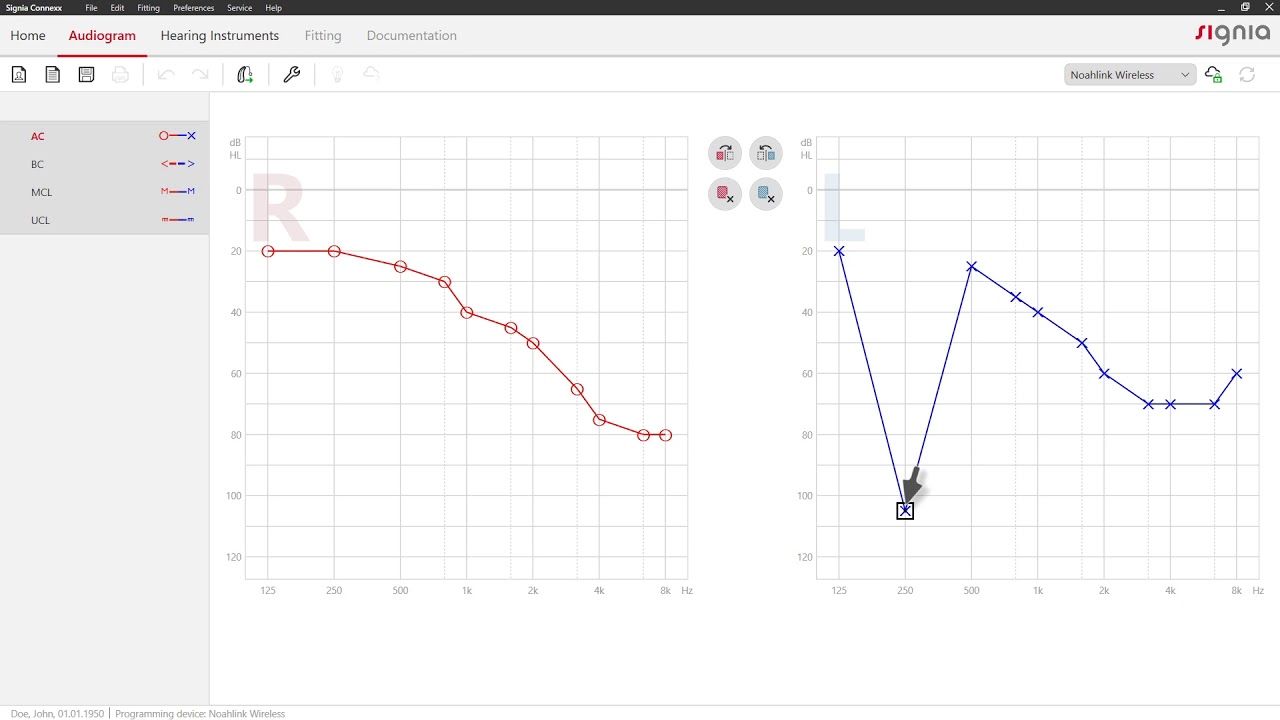 Enter an audiogram in Connexx 9 | Signia Hearing Aids
