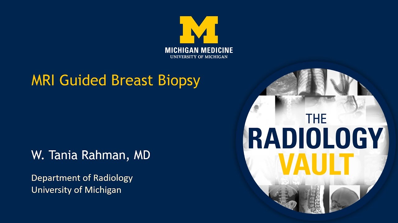 MRI-Guided Breast Biopsy