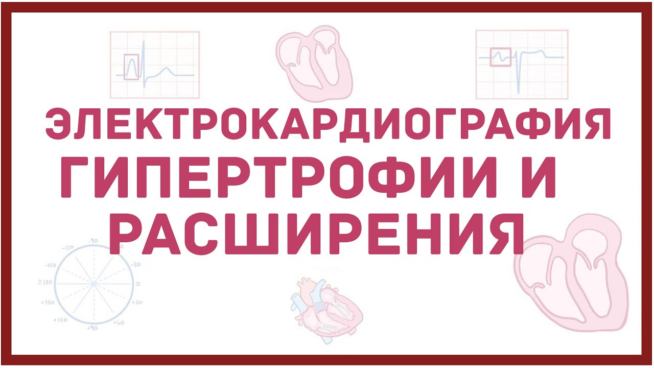 ЭКГ - признаки гипертрофии сердца, расширения его камер