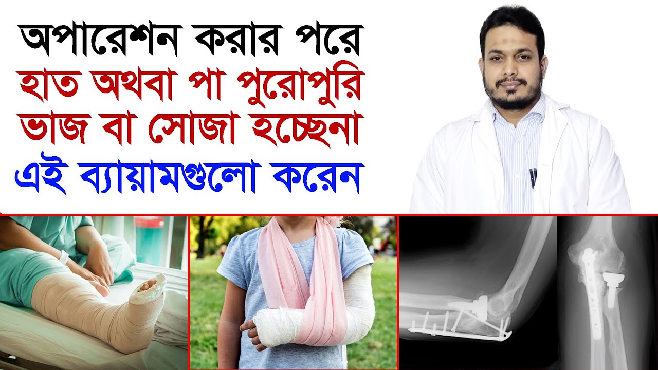 হাঁটু বা কনুই পুরোপুরি ভাজ হয় না; কি ব্যায়াম করবেন / হাঁটু ব্যথা / কনুই ব্যথা / হাড় ভাঙ্গা ব্যথা