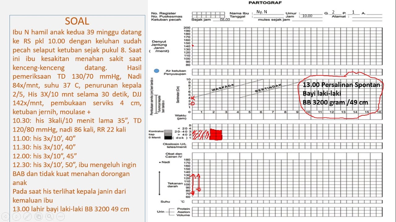 Contoh soal PARTOGRAF dan cara mengerjakannya