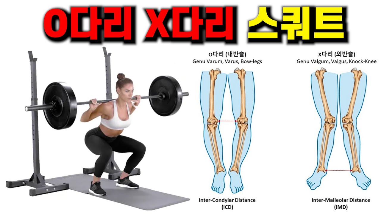 오다리,X다리가 스쿼트 하는법