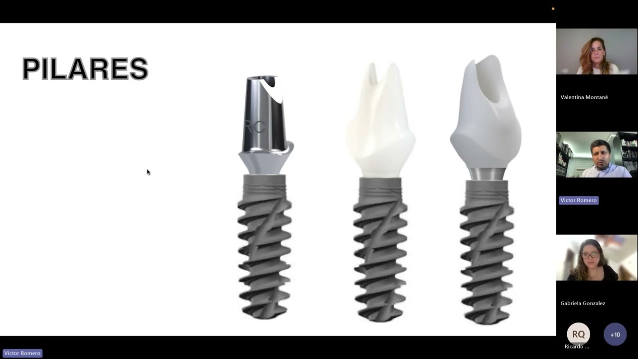 Webinar rehabilitación sobre implantes