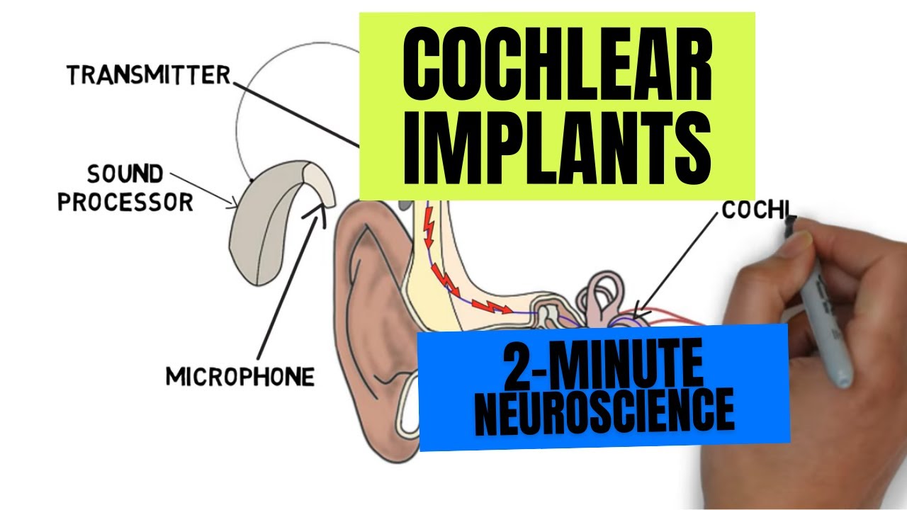 2-Minute Neuroscience: Cochlear Implants