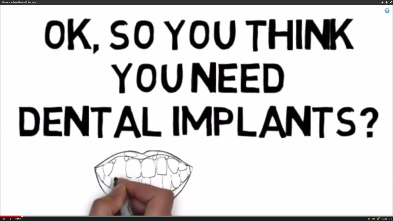 Welcome to Dental Implant Information