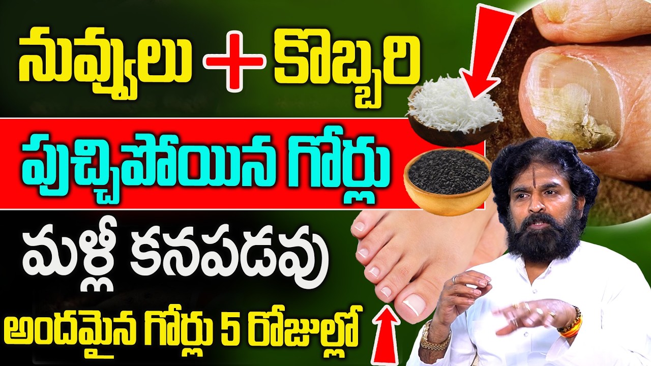 పుచ్చిపోయినా గొర్లకు, గోరుచుట్టు కు మాయం చేసే చిట్కా ..! || Goru Chuttu Home Remedy || Vikramaditya