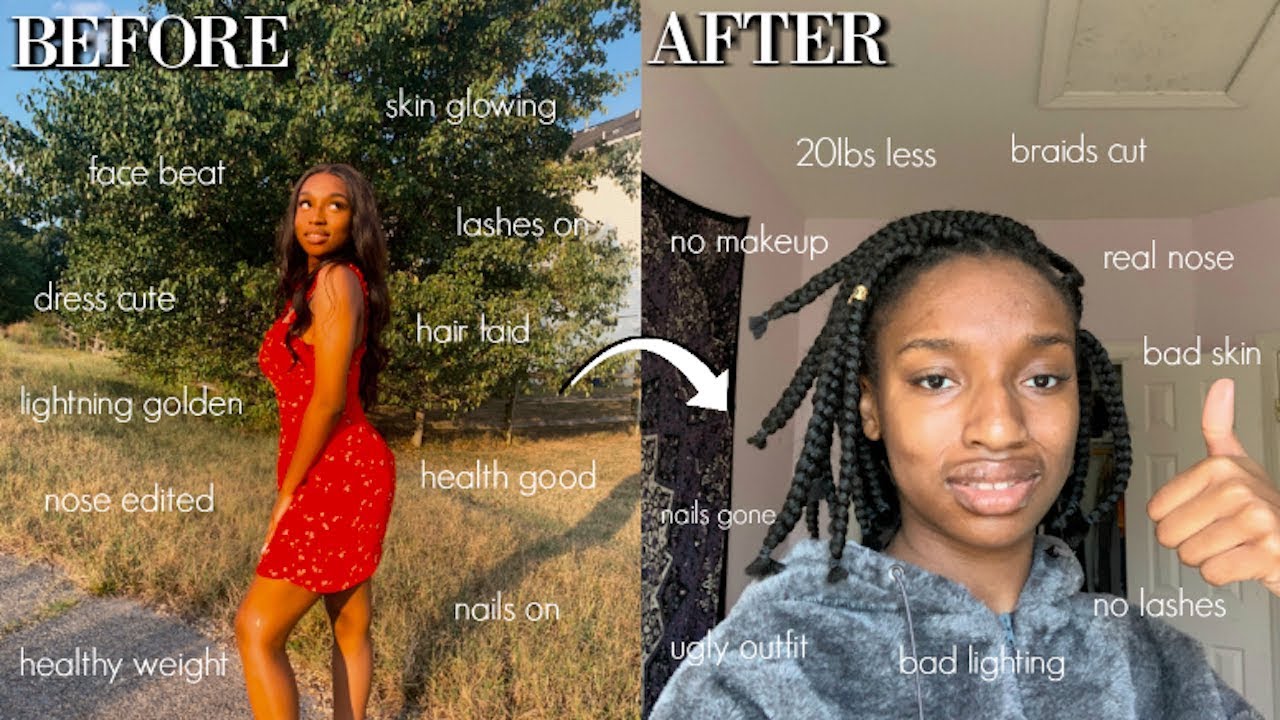 I SPENT $1000 TO GLOW DOWN BEFORE MY NOSE JOB! | Chichi Nose Best!