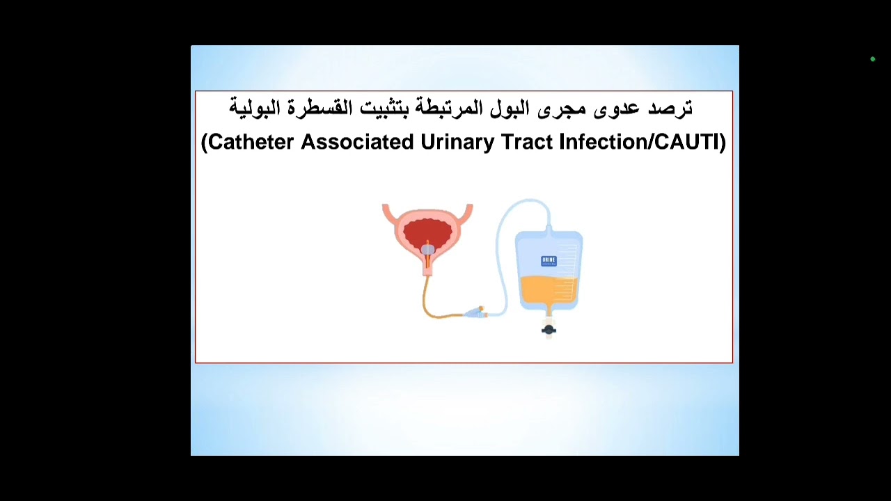 ترصد العدوى المكتسبة في قسم العناية المركزة.