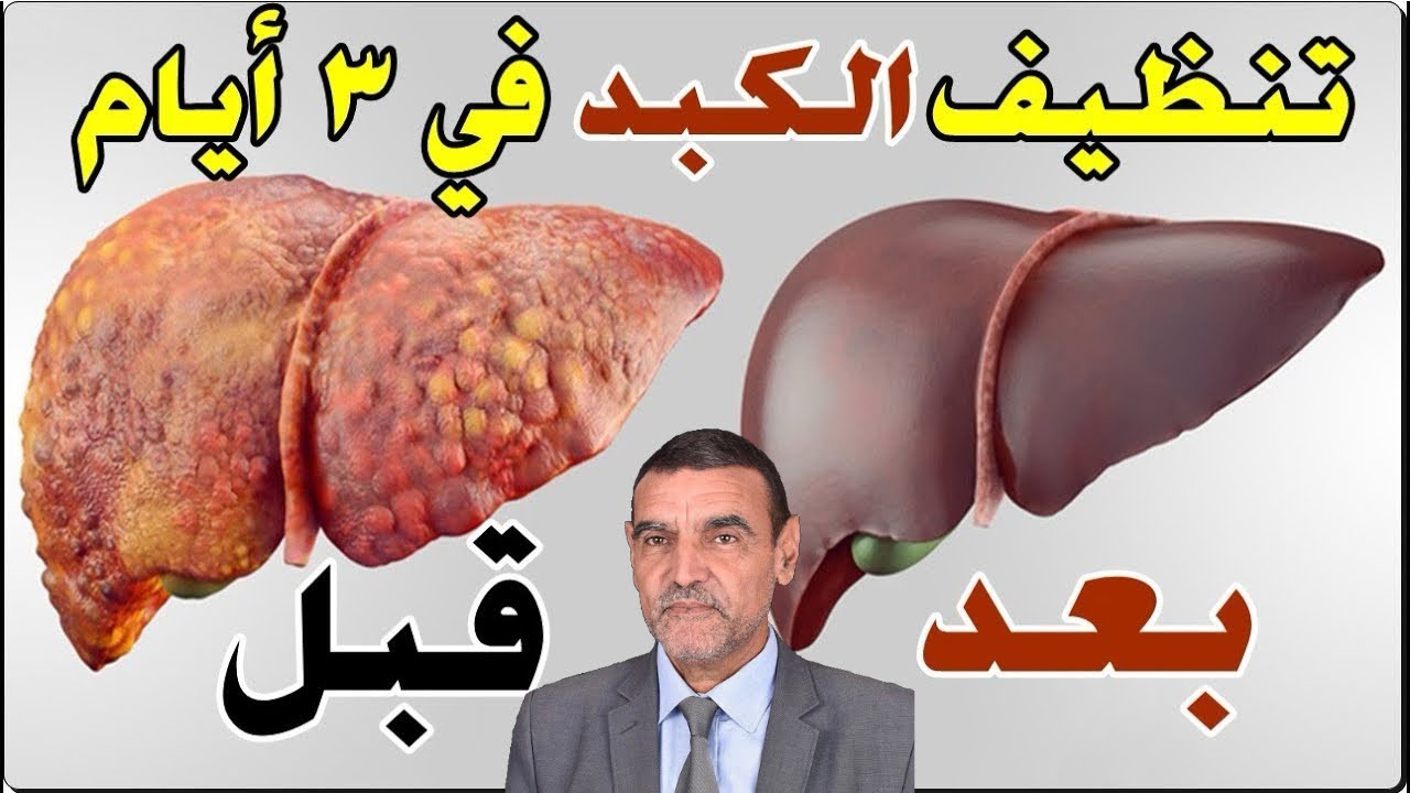 تنظيف الكبد في 3 أيام فقط 