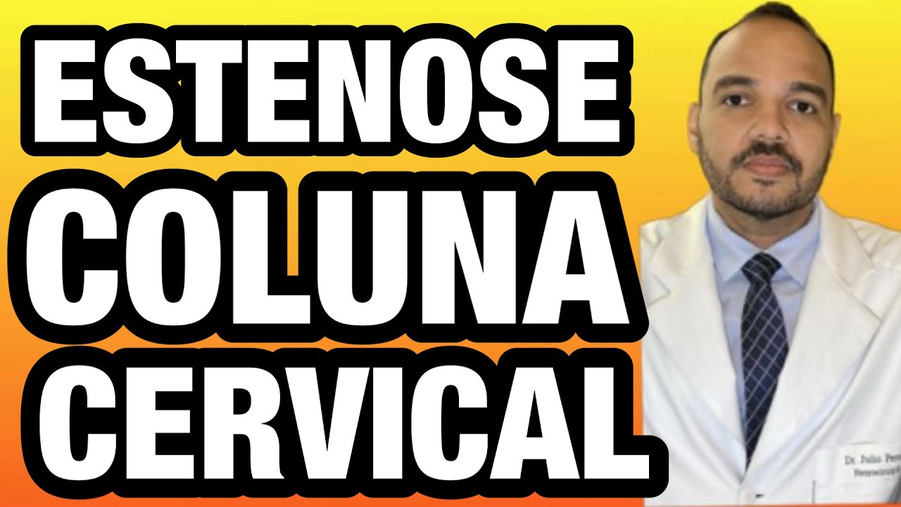Estenose da coluna CERVICAL: O que é canal estreito lombar?