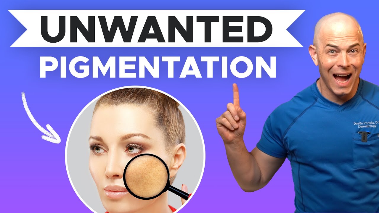 Skin Discoloration Treatment Tips | How To Get Rid Of Hyperpigmentation Quick | 208SkinDoc