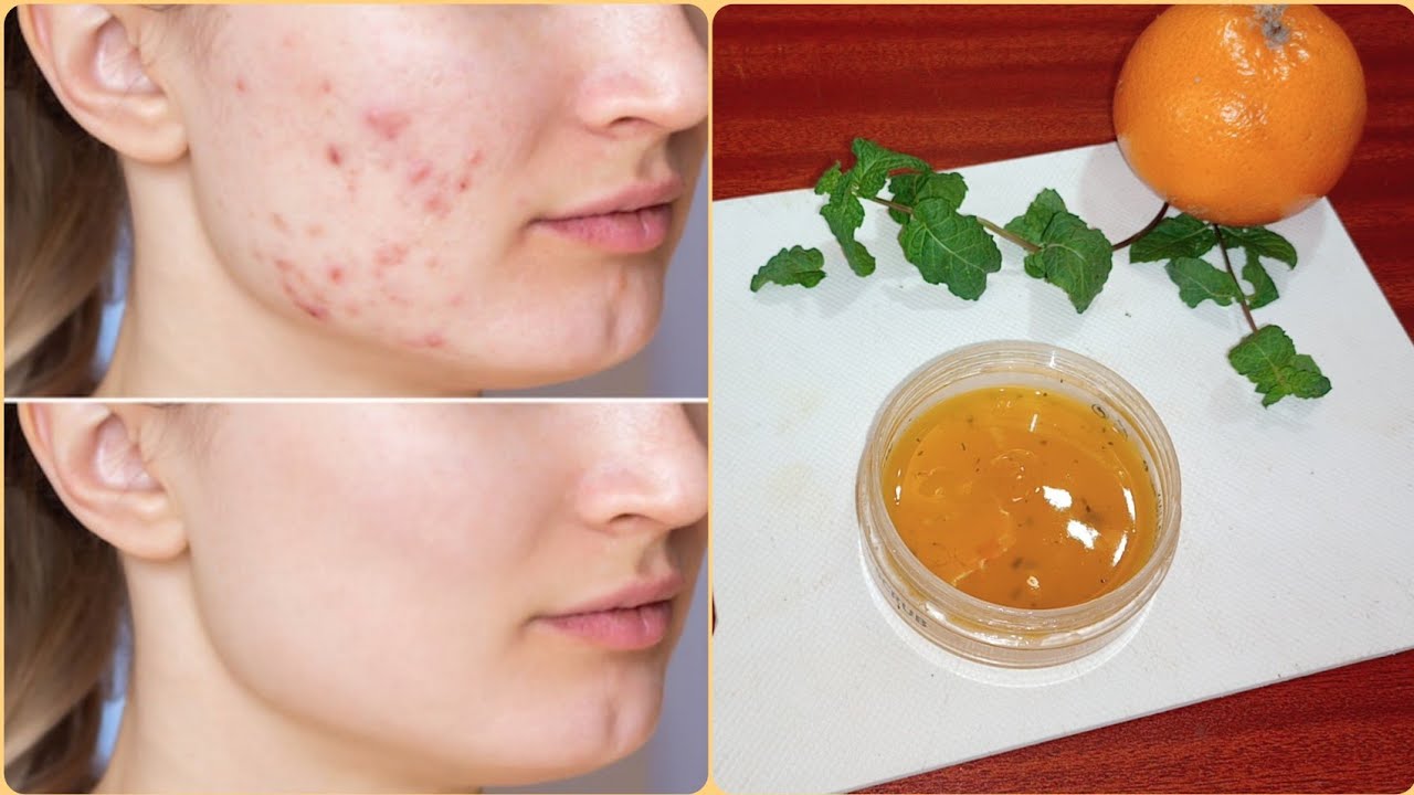 Summer Special Homemade Cream// Best Day And Night cream // Get glowing skin with DIY Summer cream