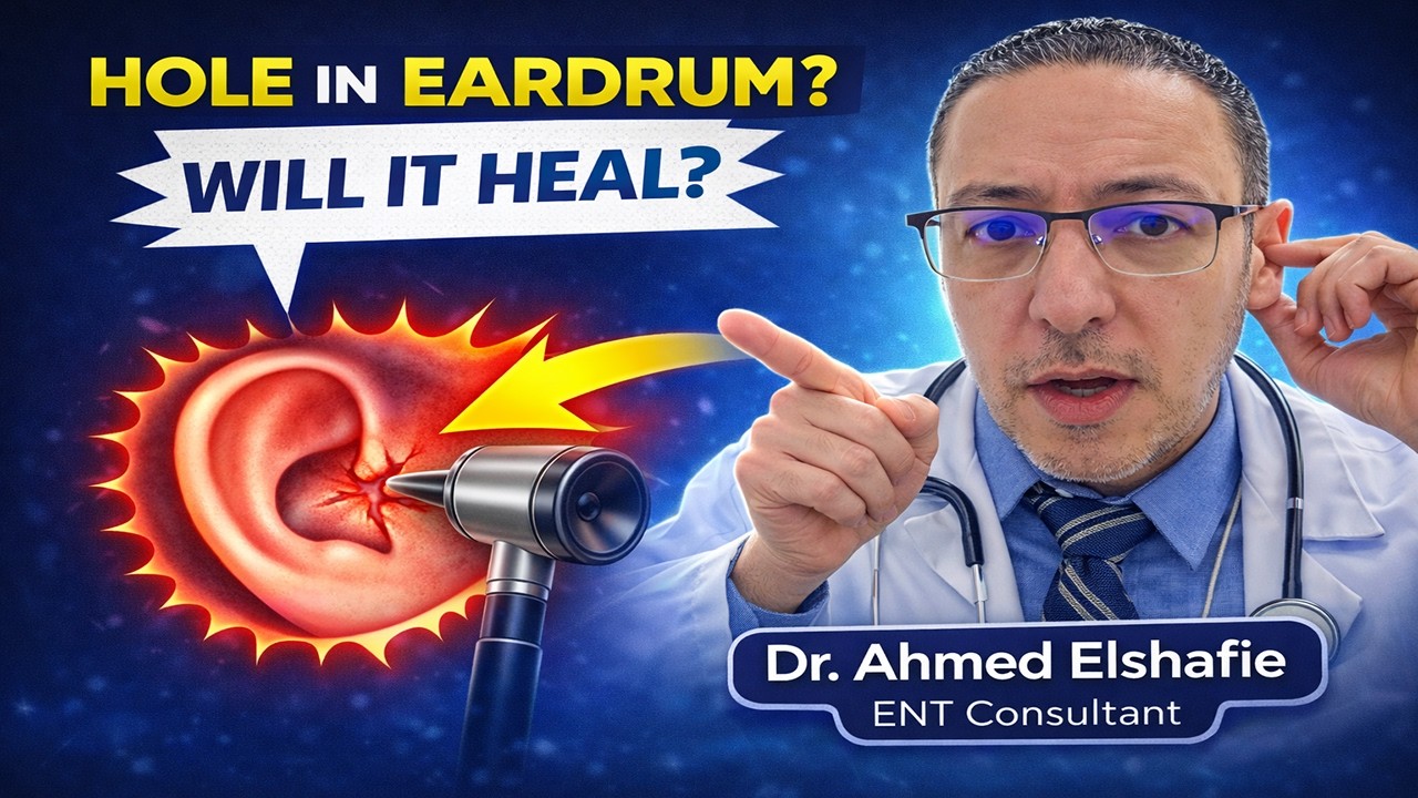 Do You Really Need Tympanoplasty? Understanding Eardrum Surgery | ProHealthConsults
