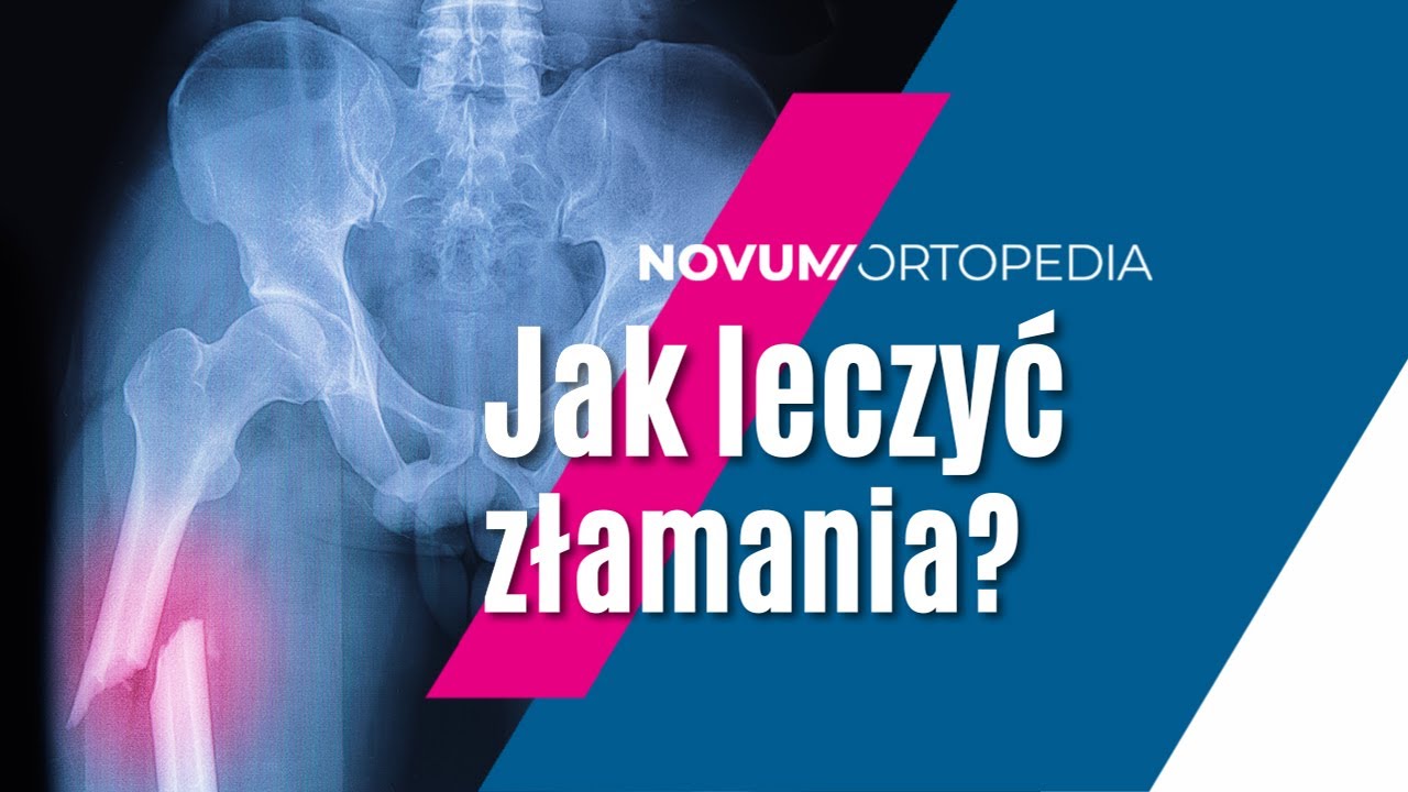 Rodzaje, metody i proces leczenia złamań kości | Novum Ortopedia
