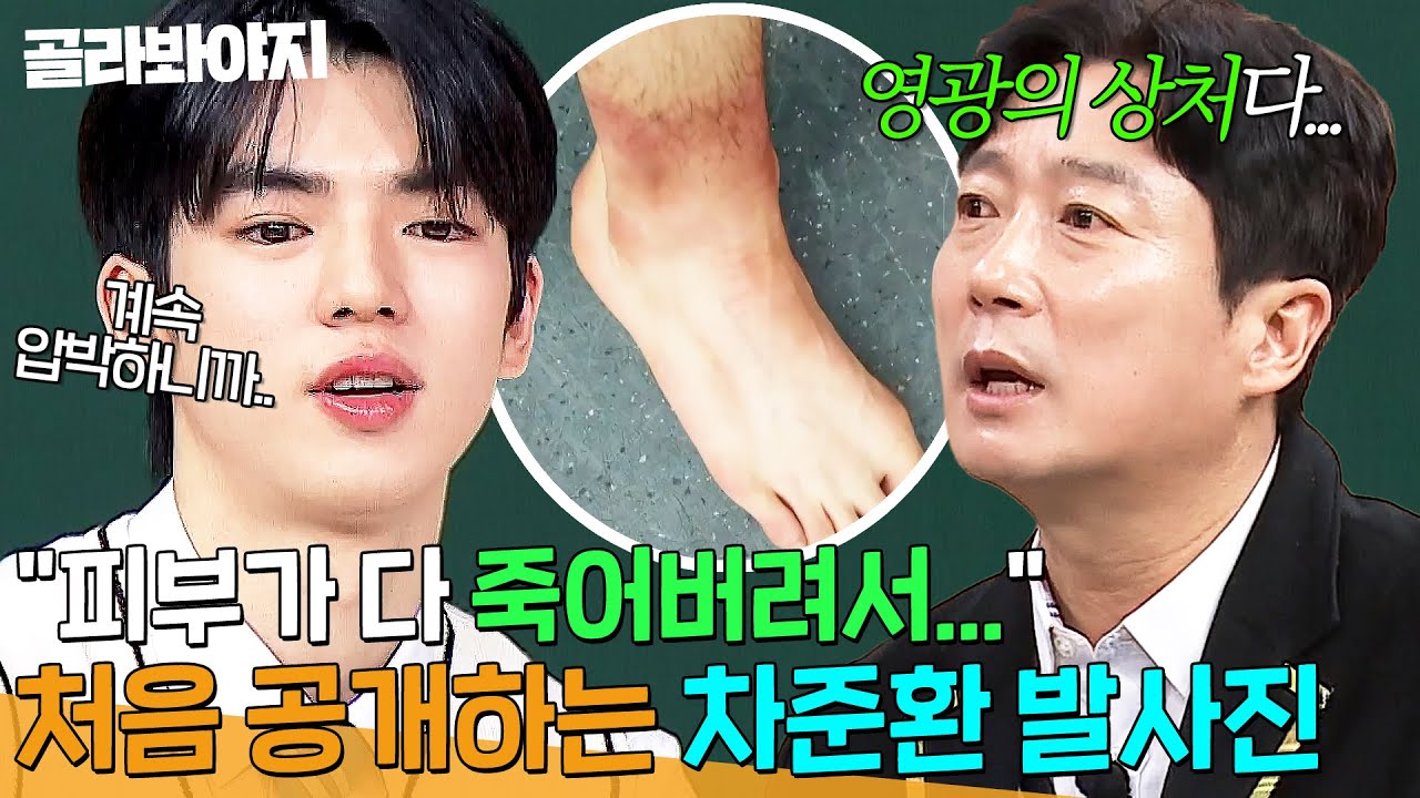 ＂영광의 상처다 진짜...＂ 부상 딛고 일어난 피겨 프린스 ✨차준환의 발 사진✨ 첫 공개｜아는 형님｜JTBC 250308 방송