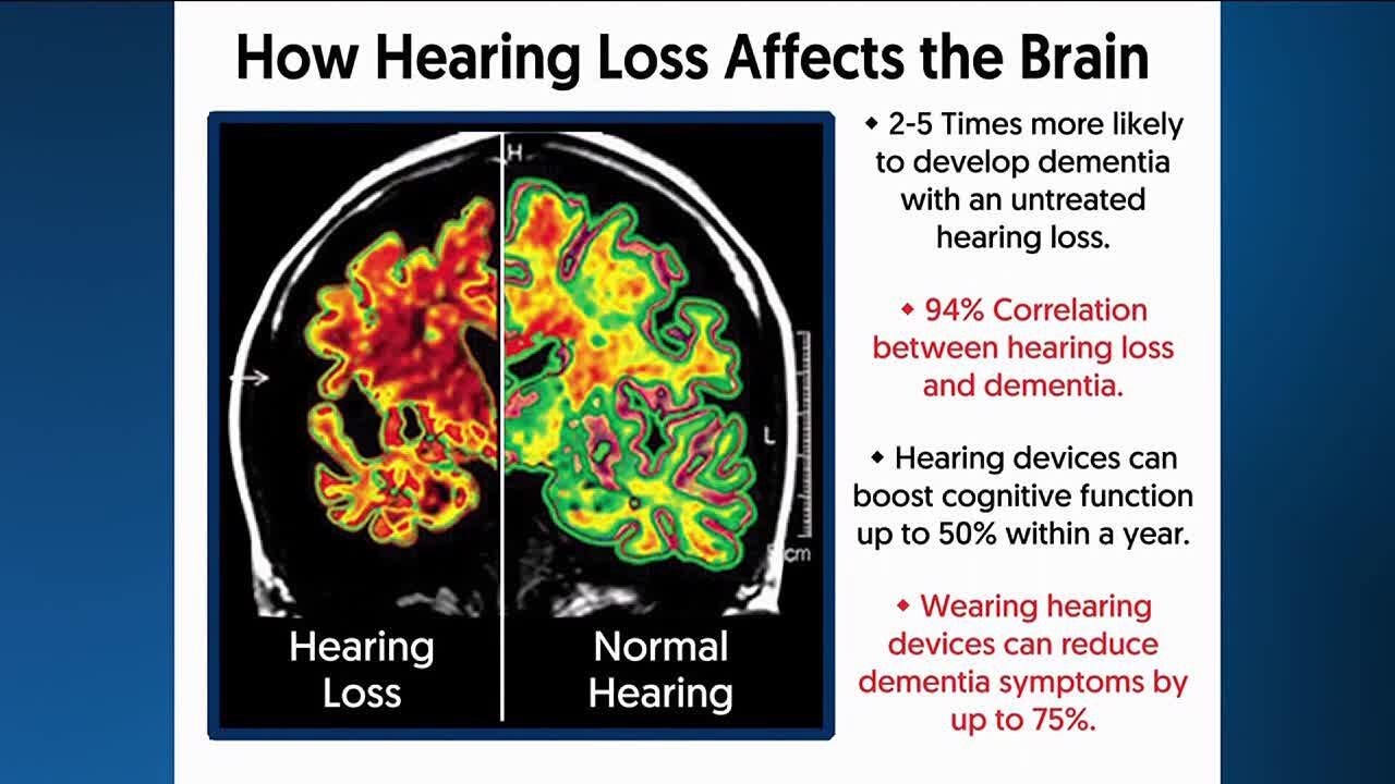 Untreated hearing loss has 94 percent correlation to dementia