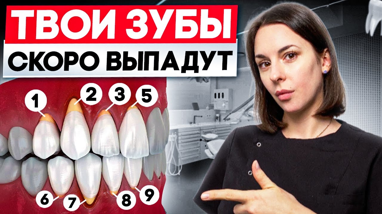 ОГОЛИЛИСЬ КОРНИ?! Как остановить рецессию десны? 5 факторов рецессии десны
