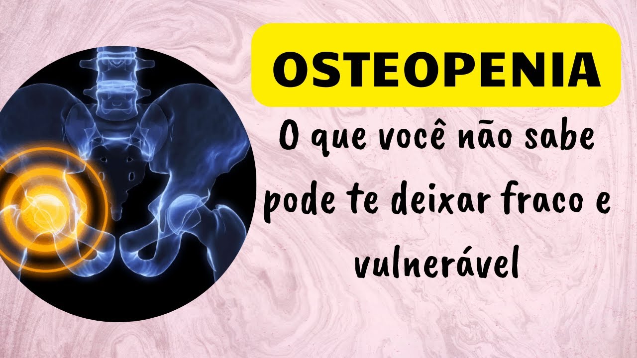 OSTEOPENIA: O QUE VOCÊ NÃO SABE PODE TE DEIXAR FRACO E VULNERÁVEL