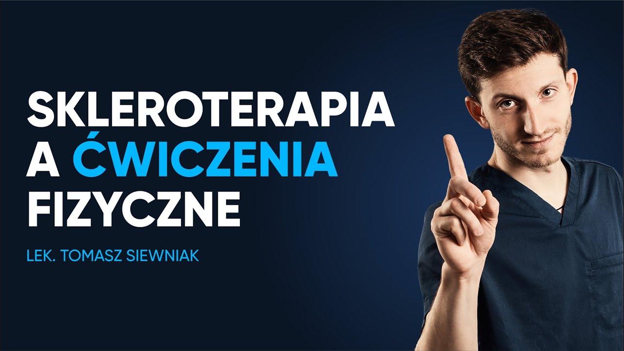 Czy po skleroterapii można ćwiczyć?